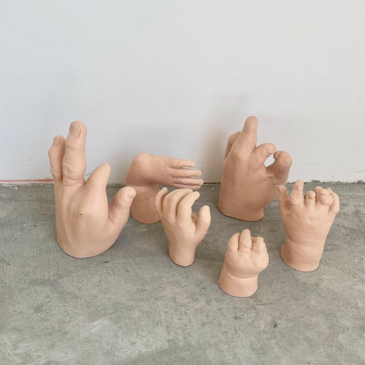 Six Anatomical Castings of Deformed Hands, 1960s USA