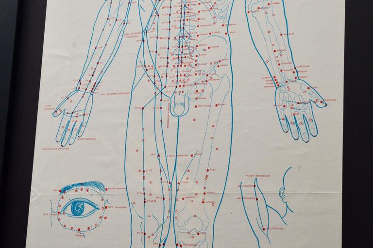 Set of Five Large 1970s Acupuncture Charts